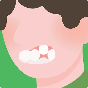 ガタガタしている