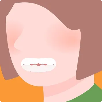 噛み合わせが浅い