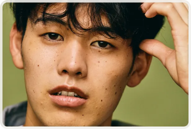 部分矯正なら最短3ヶ月から