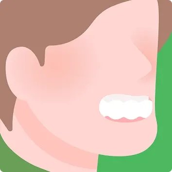 受け口で悩んでいる